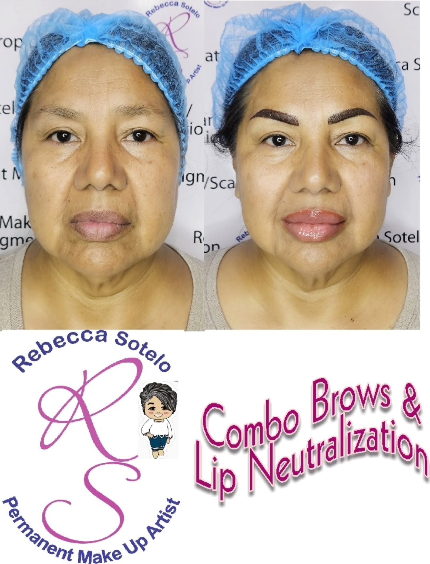 Combo brows and lip neutralization before and after